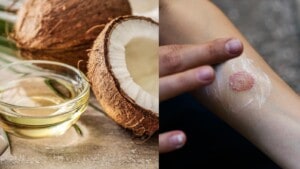 Do you have a ringworm?  My mom says using coconut oil can help